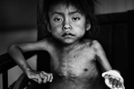 UNICEF-Foto des Jahres, 2. Preis 2011: Guatemala – gezeichnet durch chronische Unterernährung (JM Lopez, Spanien, Freier Fotograf)