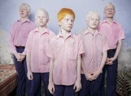 „Blinde indische Albinos“: In einer Blindenschule in Westbengalen (Brent Stirton (Südafrika)/Getty Images)