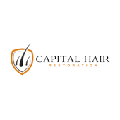Hair transplant Cambridge