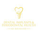 Dental Implants Periodontal Health