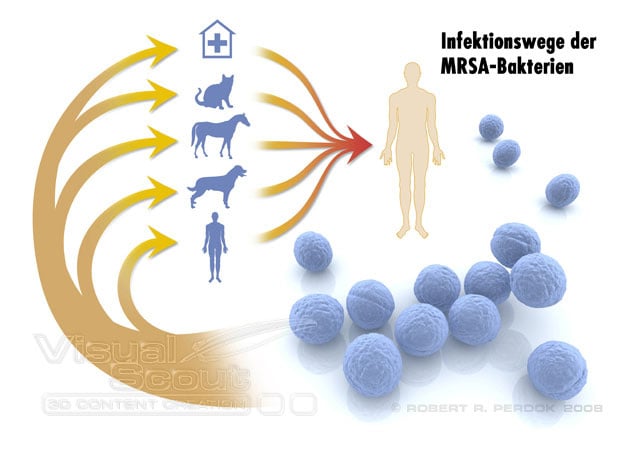 MRSA-Bakterien