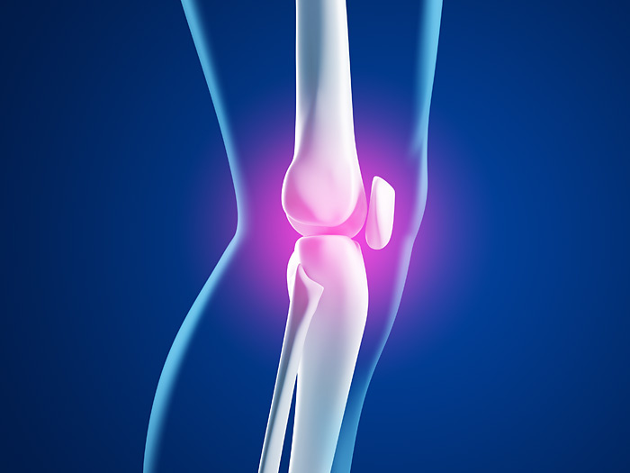 Kniegelenkschmerzen – anatomische 3D-Illustration