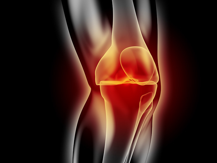 Anatomische 3D-Illustration Kniegelenkschmerzen für den medizinischen Bereich