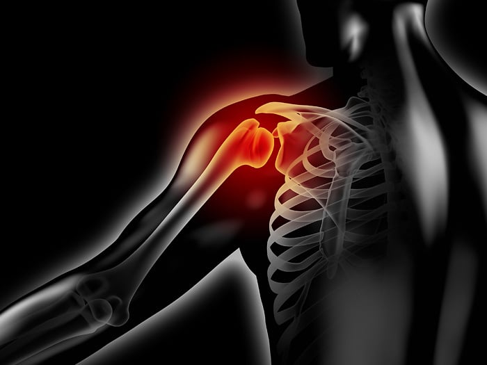 Schulterschmerzen: 3D-Visualisierung / Schultergelenk: anatomische 3D-Illustration
