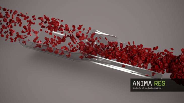 3d animated blood flow – Windkessel effect