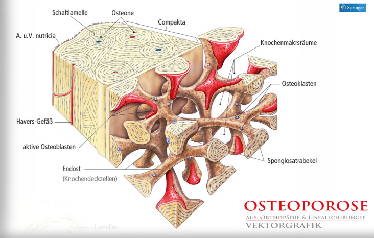 OSTEOPOROSE, Illustrationen für „Orthopädie & Unfallchirurgie“ /  2011