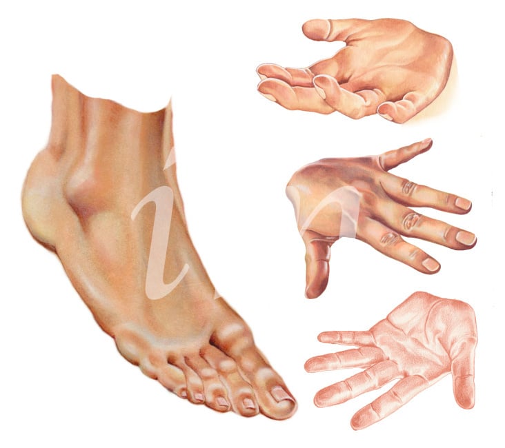 Hände und Füße, verschiedene Techniken