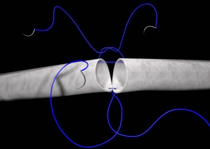 Grafik Nahtkurs1, für Klinikum Heidelberg