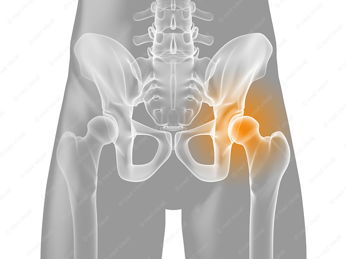 Anatomische 3D-Illustration – Gelenkschmerzen