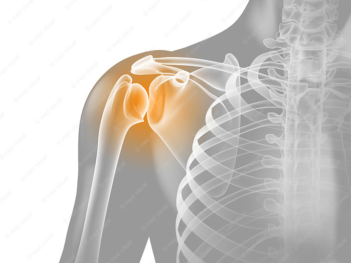 Medizinische 3D-Illustration – Schulterschmerzen Anatomie
