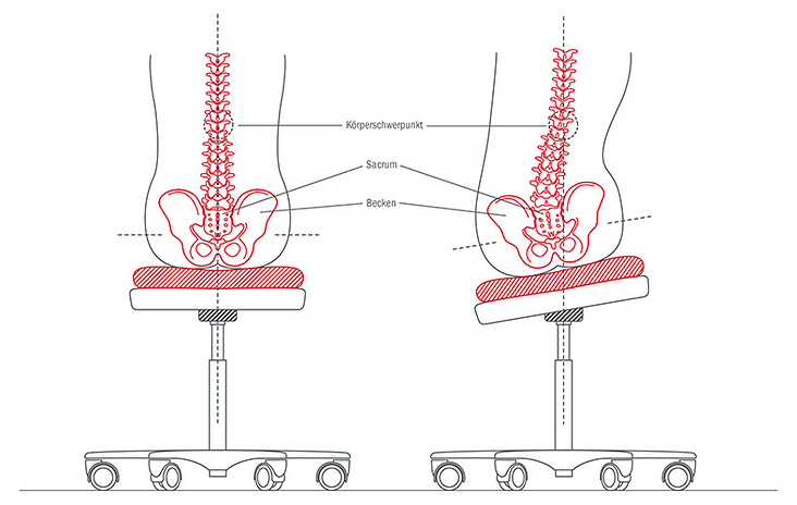Buchillustration: Visualisierung der Beckenkippung bei seitlich geneigter Sitzfläche