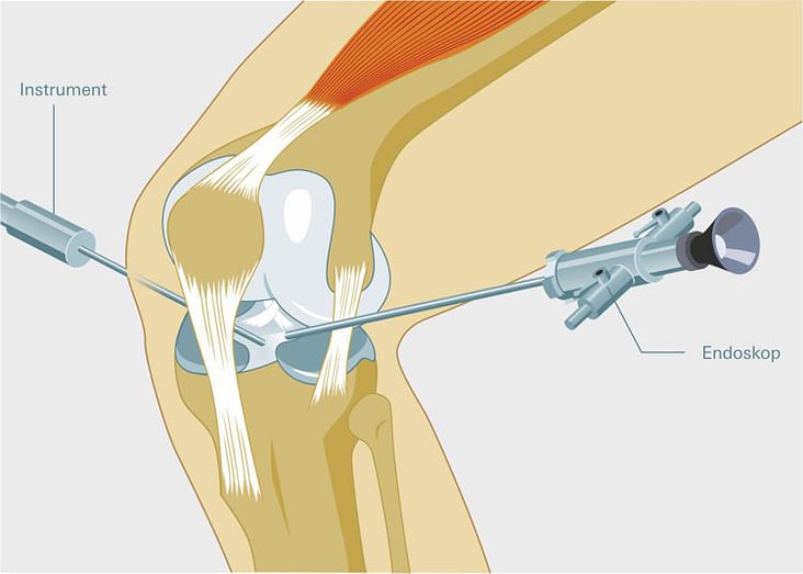 Illustration zu einem Gesundheitsratgeber. Kunde: Stiftung Warentest