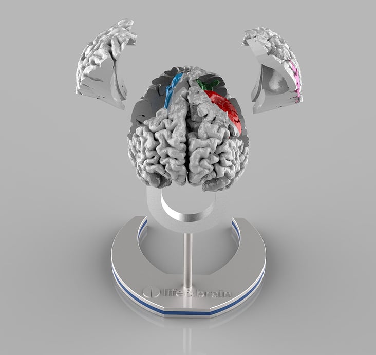 The Brain 3D Visualisierung für Uni Klink Bonn Neurologie