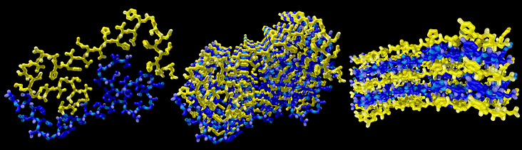 Aggregation amyloider Plaques (von links nach rechts): Dimeres Proteinfragment, höhere Aggregate frontal und seitlich