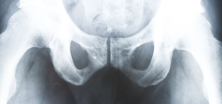 Röntgen – Becken