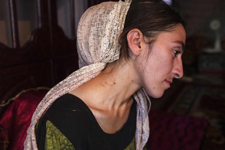 Nazira Barotovo, 25 years old.  Shows the traces of violence on her neck. After getting divorced, the court gave her and her tw