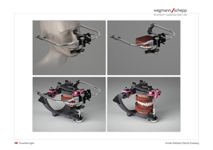 3D-Visualisierungen; Kohlbach-Dental, Kronberg