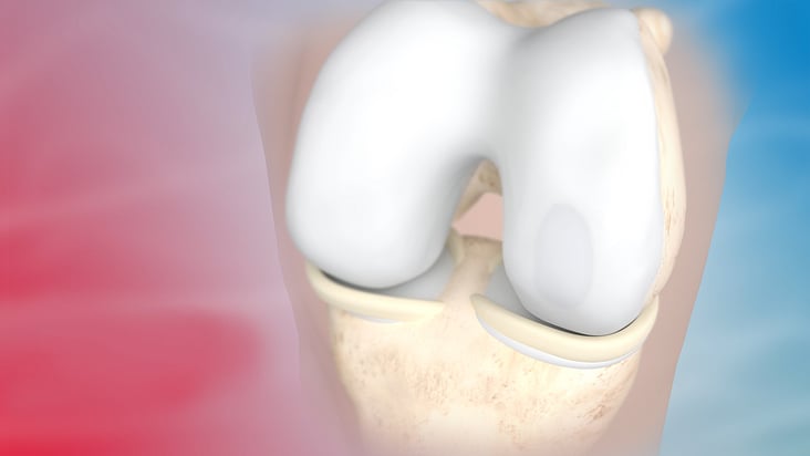 Animation ChodroFiller liquid: Knorpelregeneration