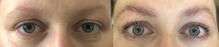 Wimpern- & Augenbrauenlifting