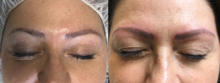 Microblading