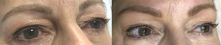 Microblading