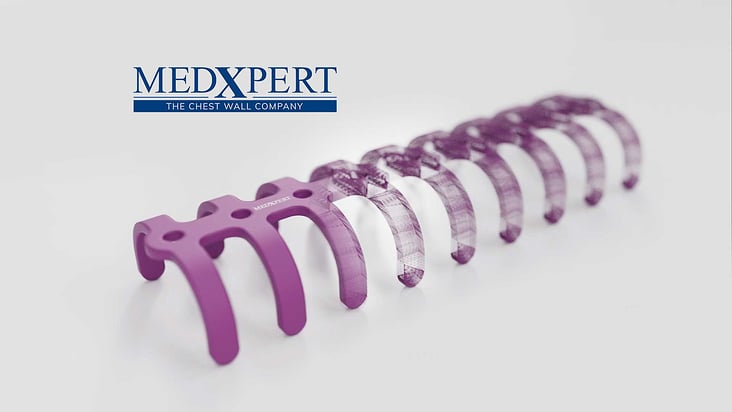 MedXpert STRACOS 3D‑Rippenklammer 3D-Animation