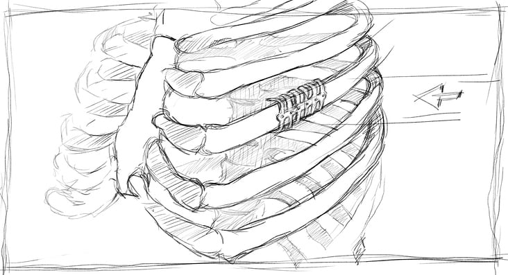 MedXpert STRACOS 3D‑Rippenklammer 3D-Animation Storyboard