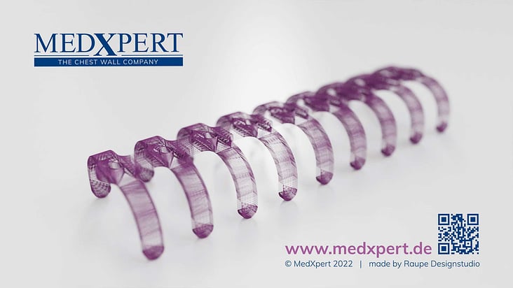 MedXpert STRACOS 3D‑Rippenklammer 3D-Animation Outro