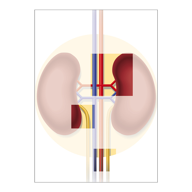 Illustration für Kongressposter ­– Nierentransplantation