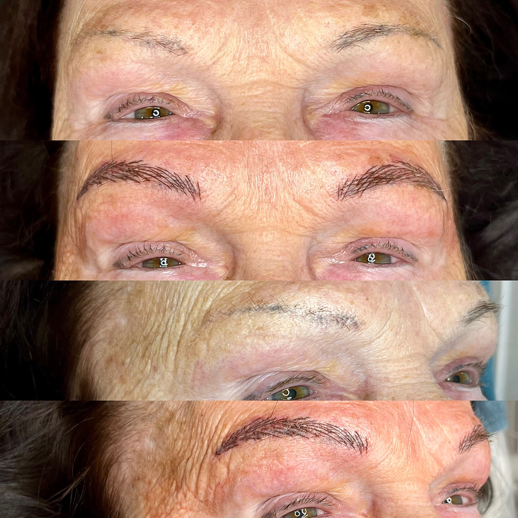 Microblading