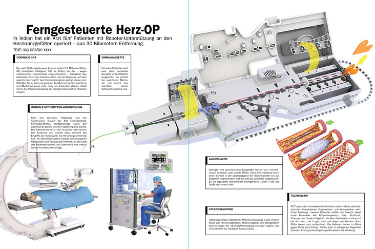 CORINDUS GRX HERZ CHIRURGIE / ROBOTIC HEART SURGERY