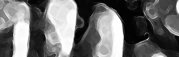 Hochrechnen von Highend-Scans