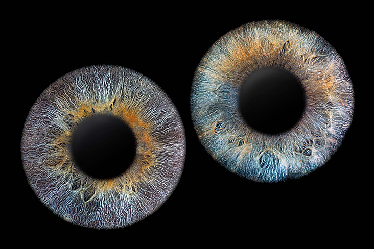 Iris Foto Beispiel