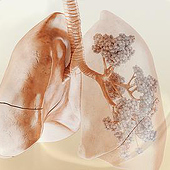 „3D-Animation Lunge Atemwege“ von core21