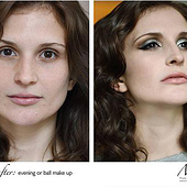 „Before and After“ von Miyu Haydn