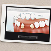 „Illustration „Zahnimplantate““ von Vierzehnneunzehn Grafische Gestaltungen
