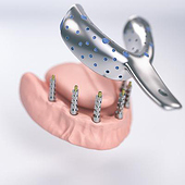 „Zahnmedizin und Implantologie Infografics“ von Zoran Marjanovic