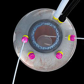 Agencies: “medizinische Animationen” from Thomas Cramer