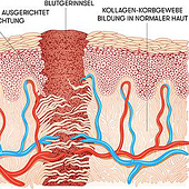 «Medical 2D-Illustration» de medicfilm® Andrej Piatkowski