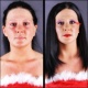 vorher/nachher