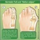 Fußknochen Fehlstellung mit Erklärung