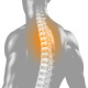 Rückenschmerzen: Röntgenbild der Wirbelsäule – 3D Illustration / 3D Grafik