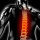 Anatomische 3D Illustration / 3D Grafik: Rückenschmerzen – Röntgenbild der Wirbelsäule