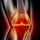 Anatomische 3D-Illustration Kniegelenkschmerzen für den medizinischen Bereich