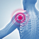 Medizinische 3D-Illustrationen / anatomische 3D-Grafiken: Gelenkschmerzen im Schulterbereich