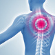 Rückenschmerzen – anatomische 3D-Illustration / Medizinische 3D-Visualisierung der Wirbelsäule