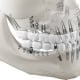 Zahnimplantate: medizinische 3D-Visualisierung / 3D-Illustrationen von Schraubenimplantaten und Plattenimplantaten