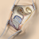 „Single Stich“- Befestigungsmethode des Implantats