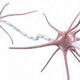 Nervenfaser einer Nervenzelle und Entzündung der Myelinscheide: 3D-Illustrationen