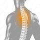 Rückenschmerzen – medizinische 3D Visualisierung